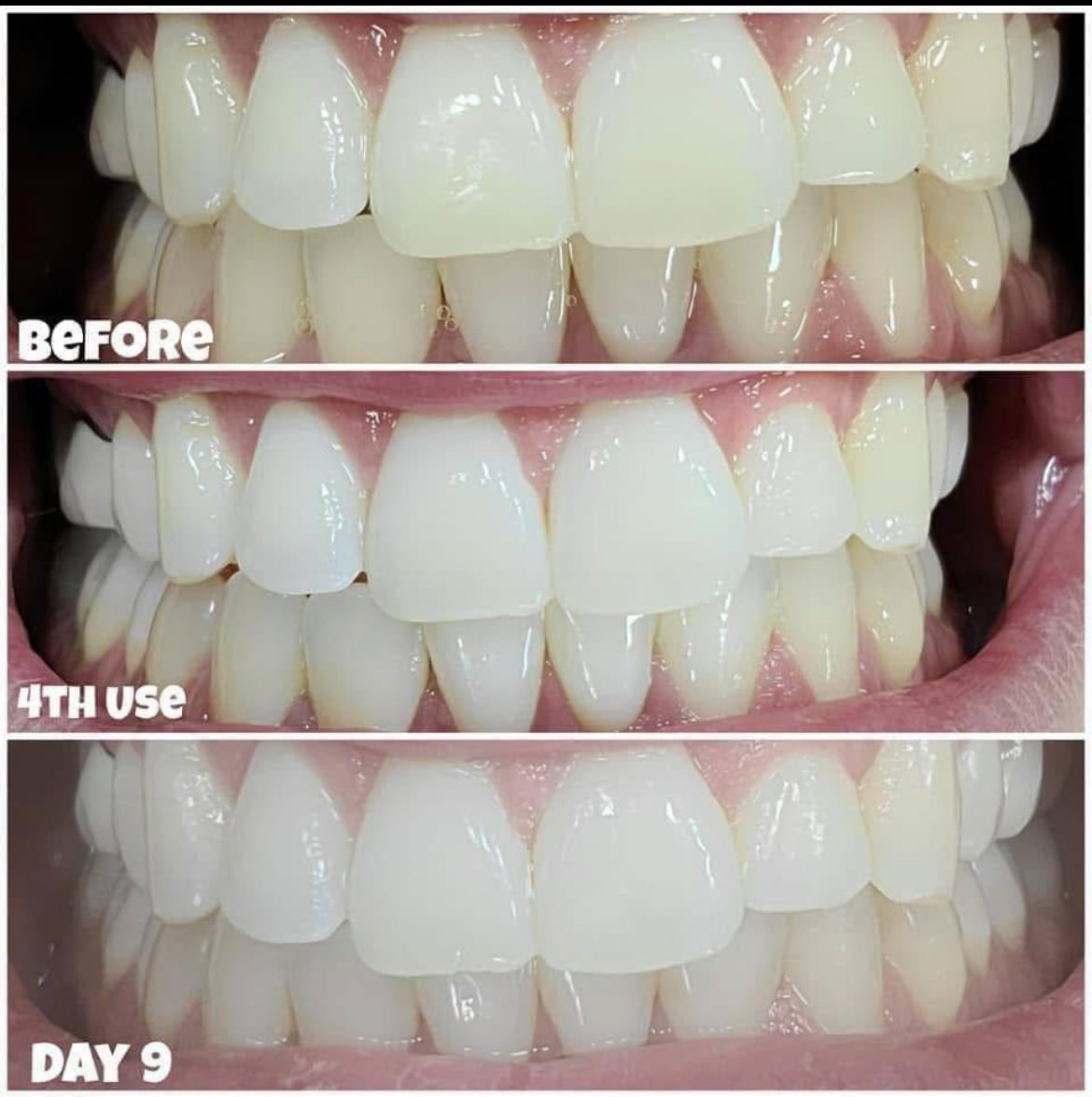 Whitening Toothpaste