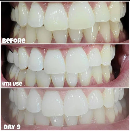Whitening Toothpaste